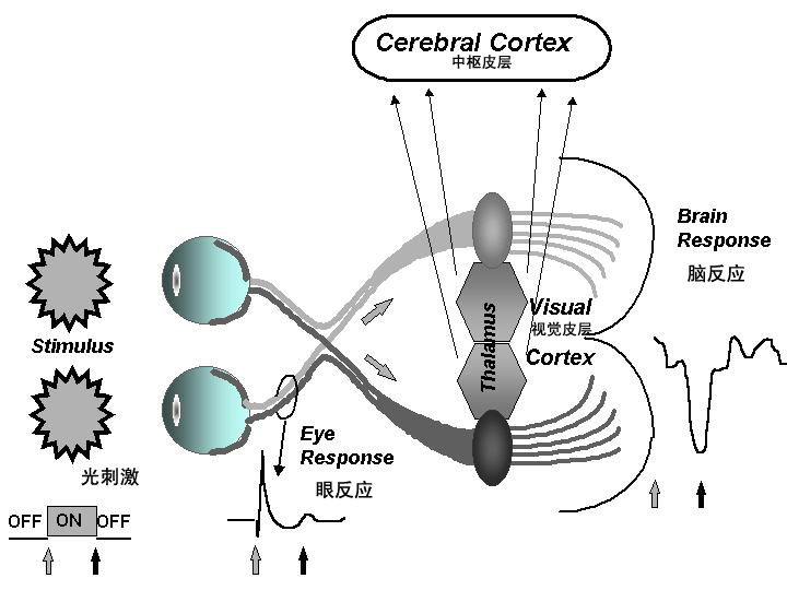 腦波治療儀