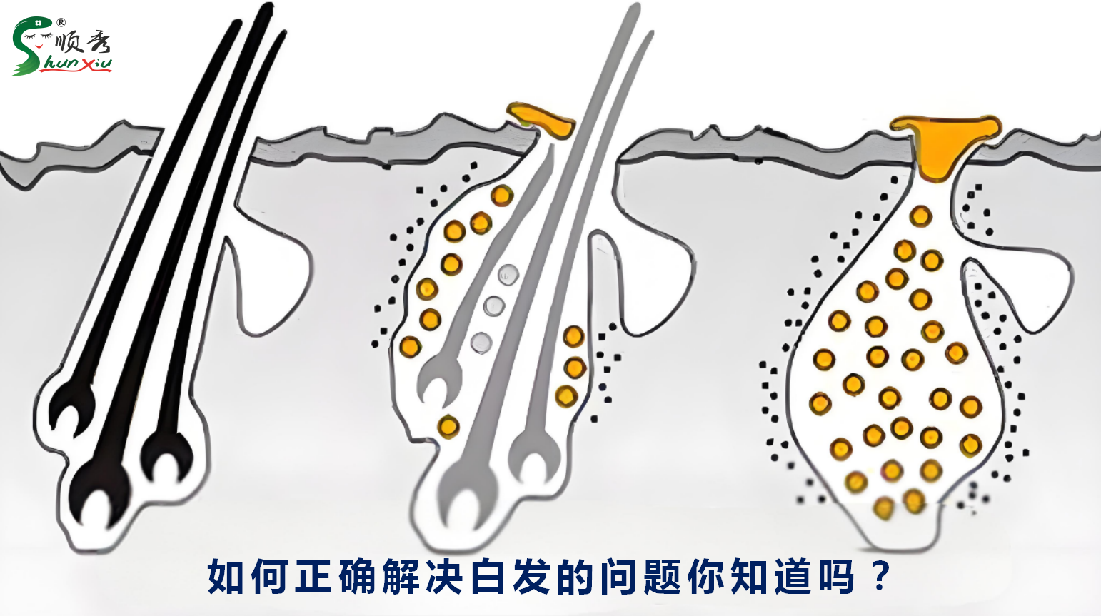 白发人群必读“白发染黑和自然转黑的区别”