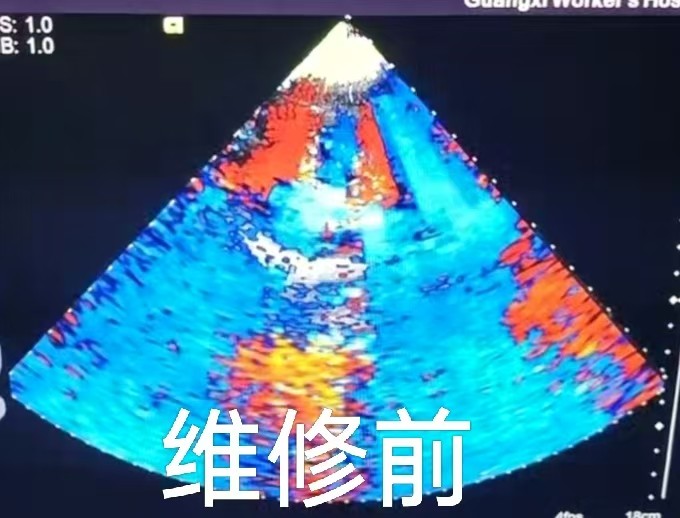 03d3b6d0071af32aa7ff848adf133e79